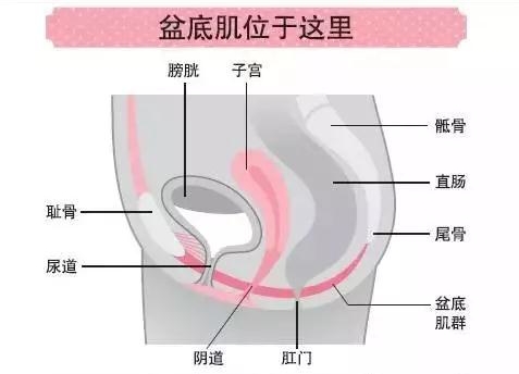 产后盆底修复