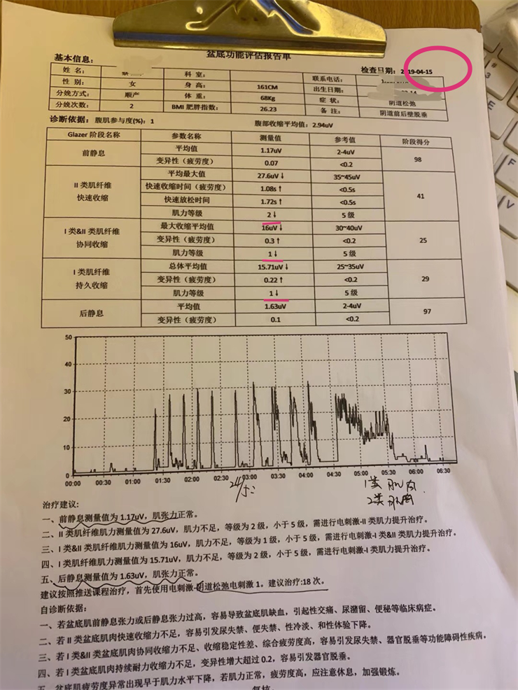 盆底肌仪器