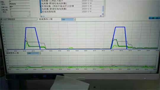 通泽医疗盆底肌仪器.jpg