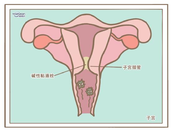 盆底康复治疗仪.jpg