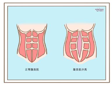 盆底肌修复仪器