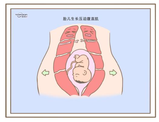 盆底康复治疗仪